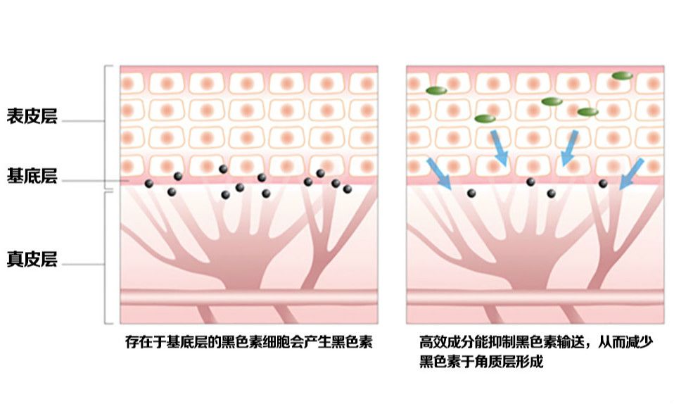 造成亚健康状况的主要原因有_导致亚健康状态的原因_亚健康状态的起因包含