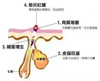 导致亚健康状态的原因_亚健康状态的起因包含_造成亚健康状况的主要原因有